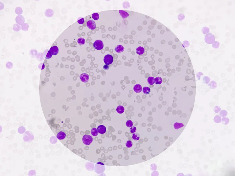 What do Leukocytes in Urine mean?