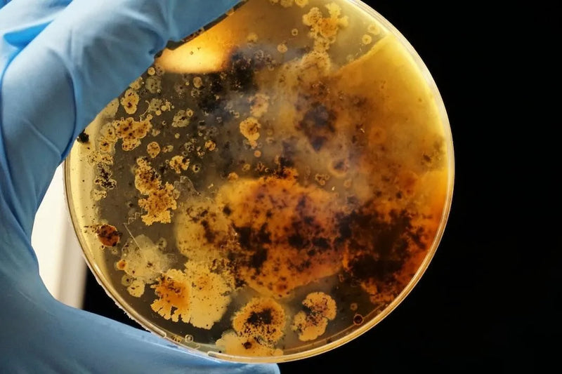 Lactobacillus in Urine