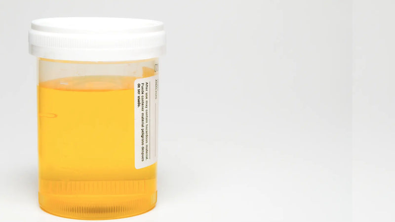 Why Does My Pee Smell Weird? What Urine Odor Says About Your Health