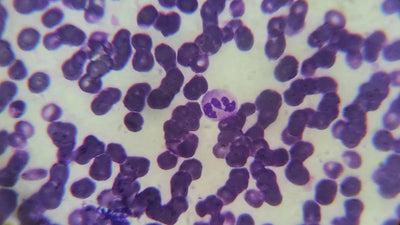 Ketones in Urine