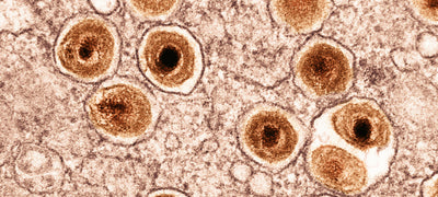 Oxidative Stress