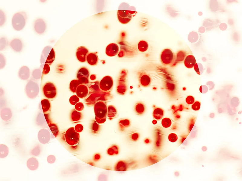 Your guide to Hematuria or Blood in Urine