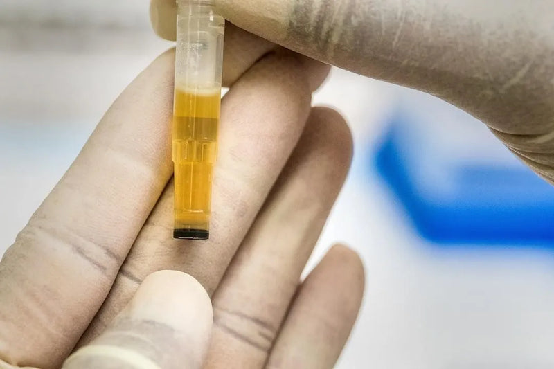 Mucus in Urine - Should You be Concerned?