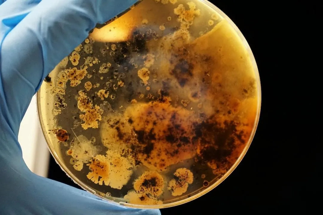 Lactobacillus in Urine
