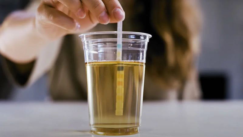 Tips To Avoid Color Bleeding on Multiparameter Urine Test Strips
