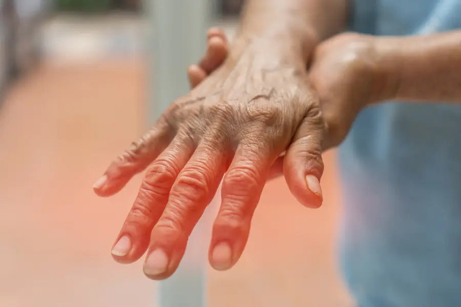 Significance of At-Home Urinalysis for Berger’s Disease