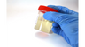 Is High pH in Urine Dangerous?