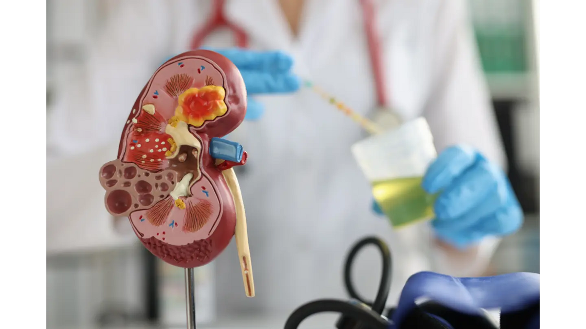 Understanding Proteinuria: Why Identifying the Cause is Key to Effective Treatment