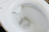 What the Color of Your Urine Reveals About Your Health