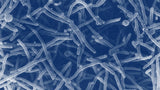 Leukocytes in Urine