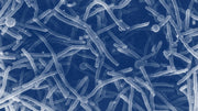 Leukocytes in Urine