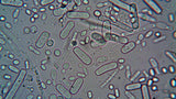 Nitrite in Urine