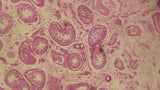 Urobilinogen in Urine