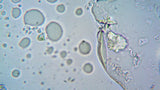 pH of Urine