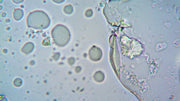 pH of Urine