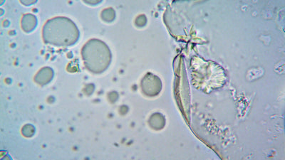 pH of Urine