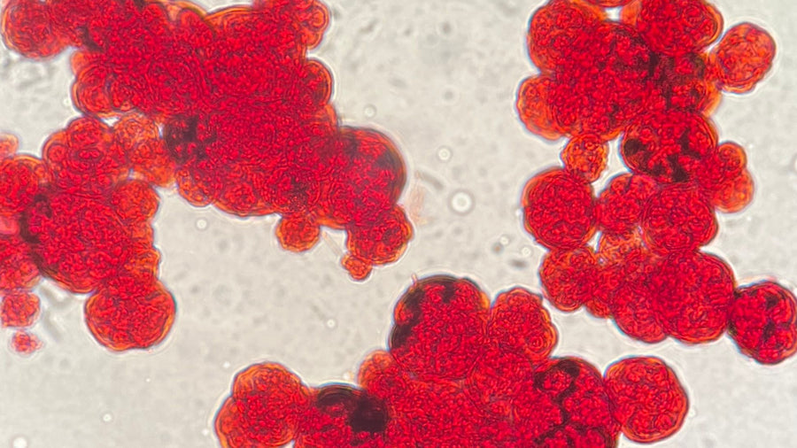 Blood in Urine