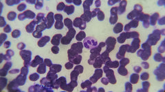 Ketones in Urine