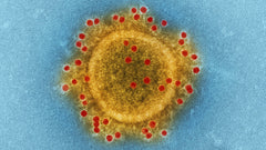 Influenza A & B Antigen
