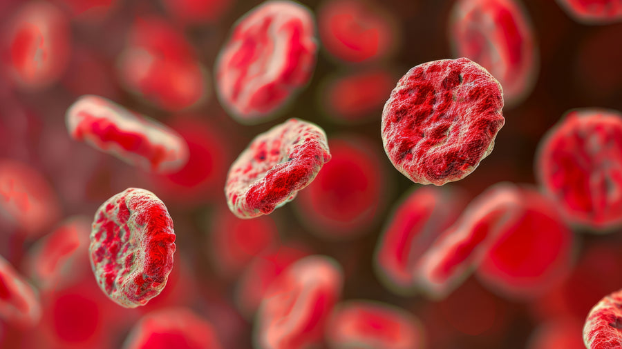 Prostate-Specific Antigen (PSA)