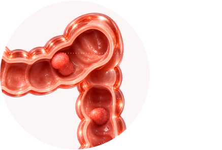 OCCULT BLOOD SCREENING