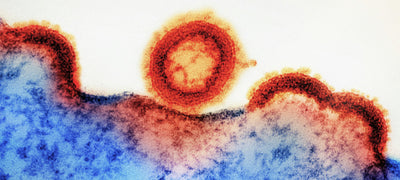 HIV