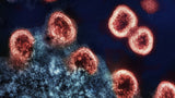 HIV-1 & HIV-2 Antibodies
