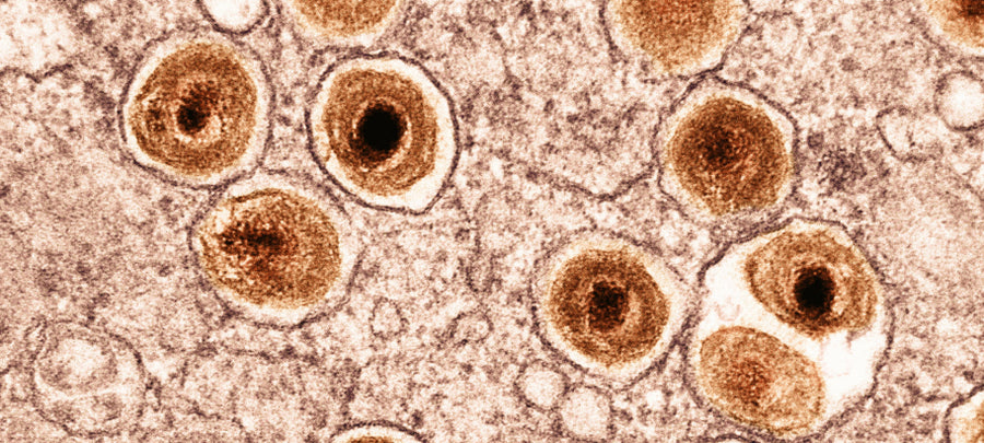 Oxidative Stress