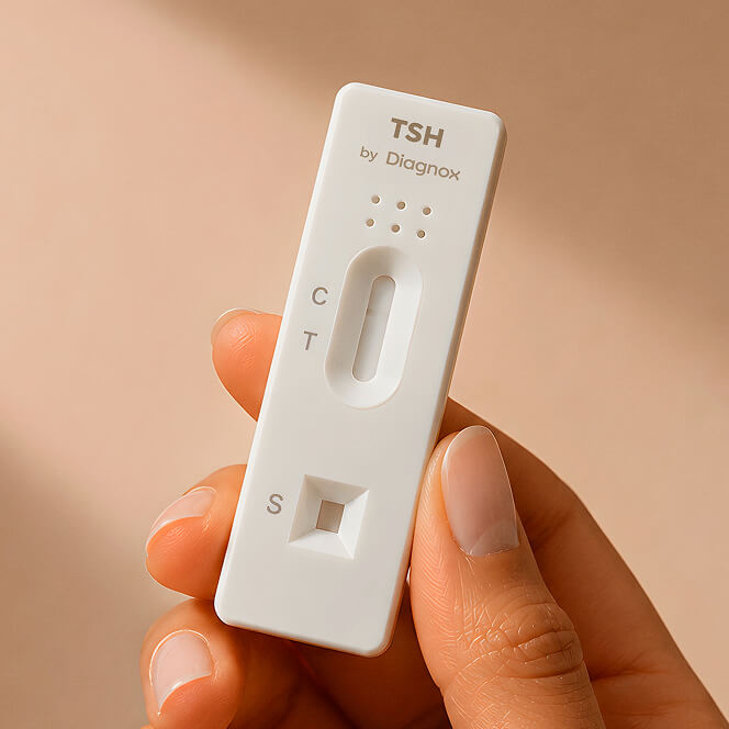 Thyroid TSH Test